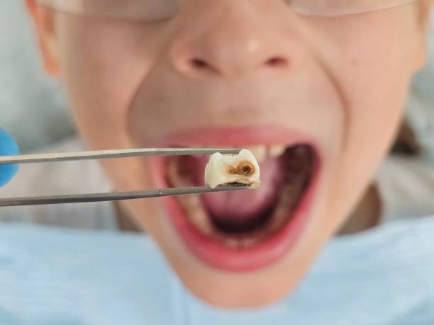 Best Emergency Pediatric Dental Care in Big Lake, TX